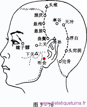 Point Ting Hui (2VB point 2VB
