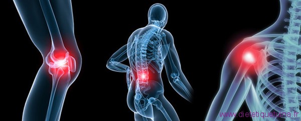 L'arthrite
