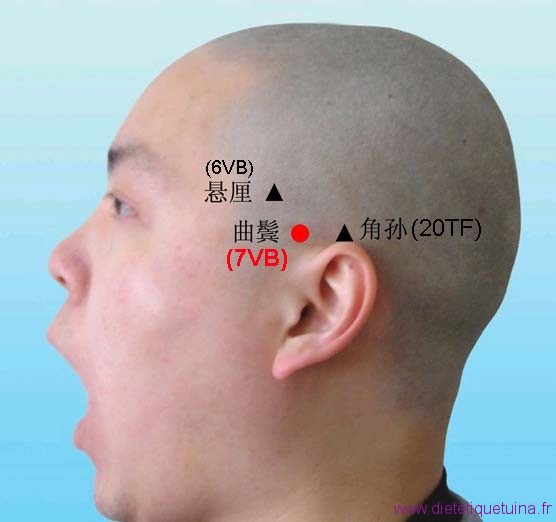 Endroit où se situe le point 7VB